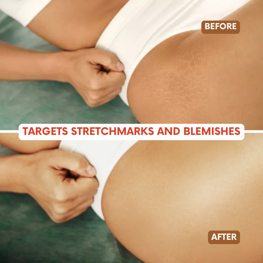 Belari Revive Oil — Wormwood & Ginger Essential Oil