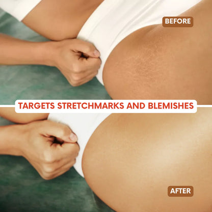 Belari Revive Oil — Wormwood & Ginger Essential Oil